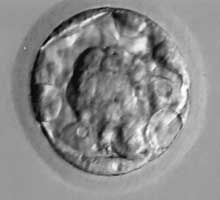 Early blastocyst IVF embryo picture