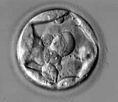 Grade 4AB blastocyst picture from IVF