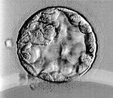 Image of 4BB grade blastocyst