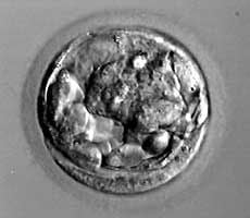 Early blastocyst from in vitro fertilization